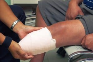 How Amputation Increases the Risk of Pulmonary Embolism